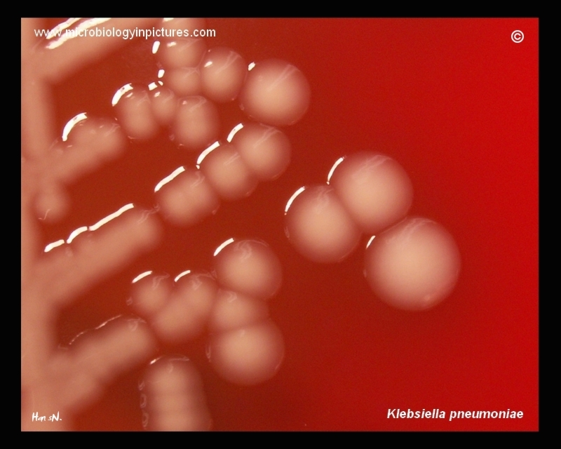 A Photo Of Klebsiella Pneumoniae Colonies On Blood Agar